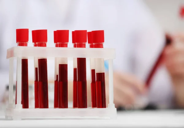 Біохімічний аналіз крові на виявлення наркотиків та ПАВ